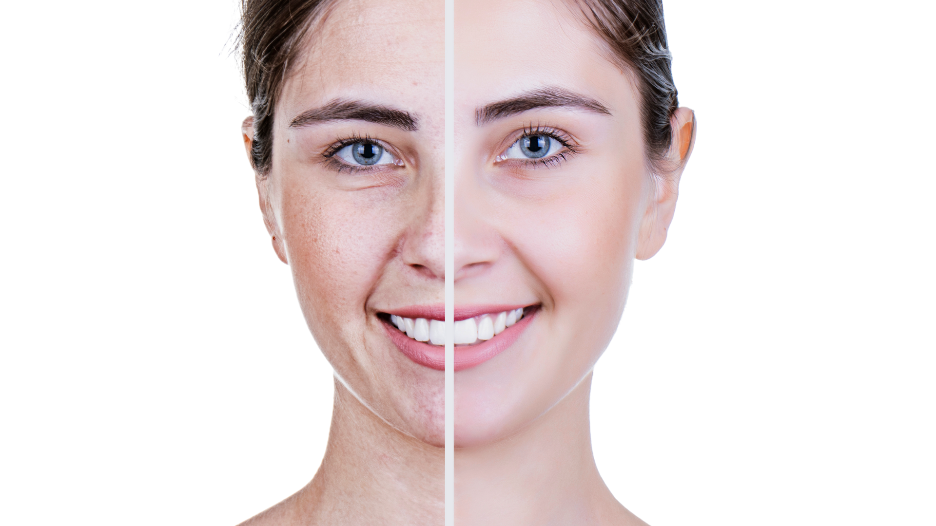 Comparison of woman with wrinkles and without